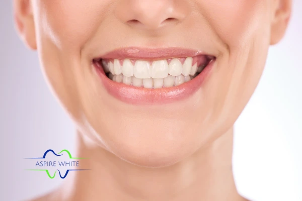 Follow your teeth whitening aftercare Loughborough to prolong your whiter smile!